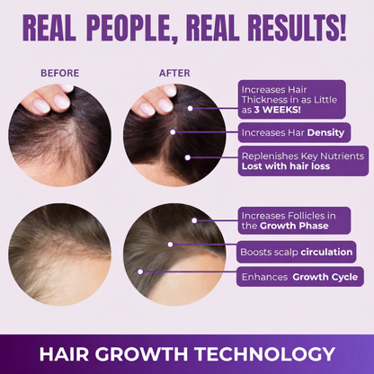Hair Growth Accelerator Gummies